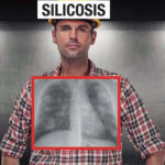 Piden cárcel para dos grandes fabricantes de encimeras de cocina por la silicosis en una marmolería Vizcaína.