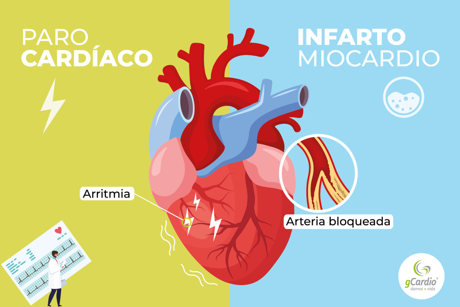 Declaran accidente laboral la muerte por infarto de un camarero tras ...
