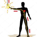 Trabajadores heridos por descarga eléctrica en una acería.